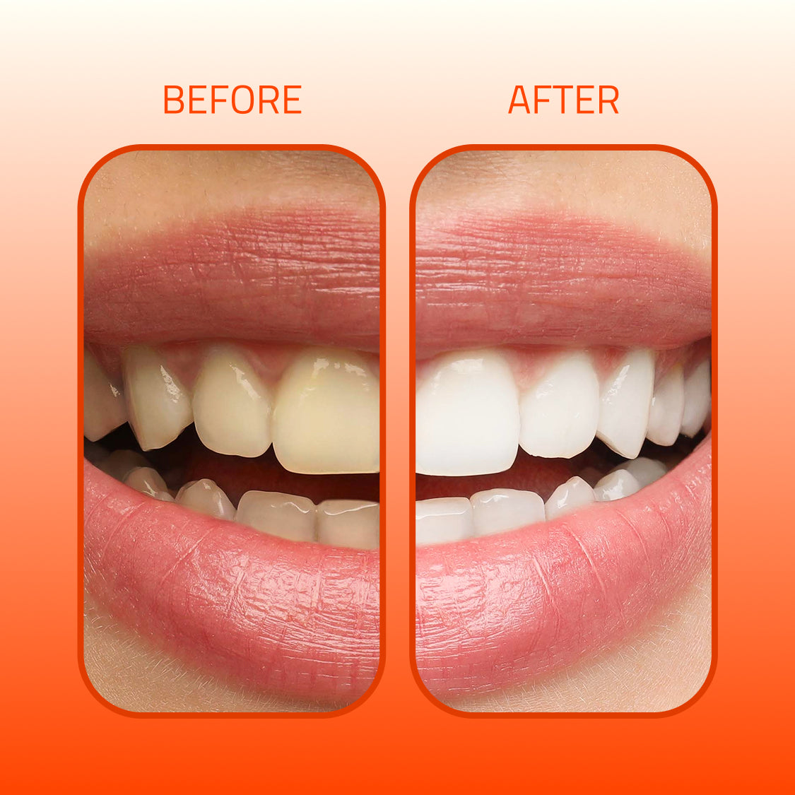 Nia Shine™ Niacinamide Whitening Toothpaste